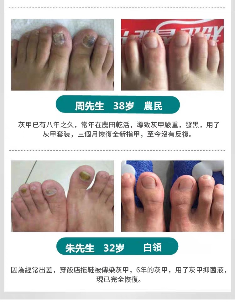 灰甲淨