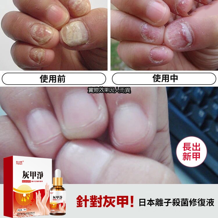 灰甲淨