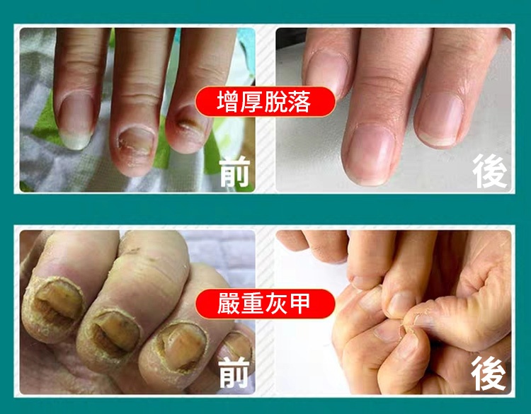 灰甲淨