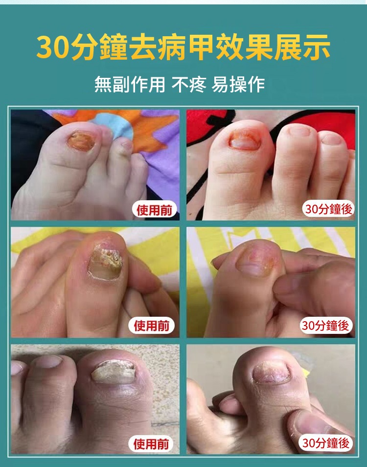 灰甲淨