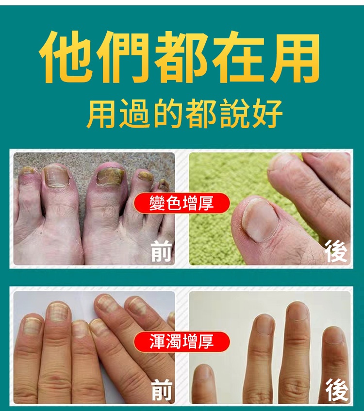 灰甲淨